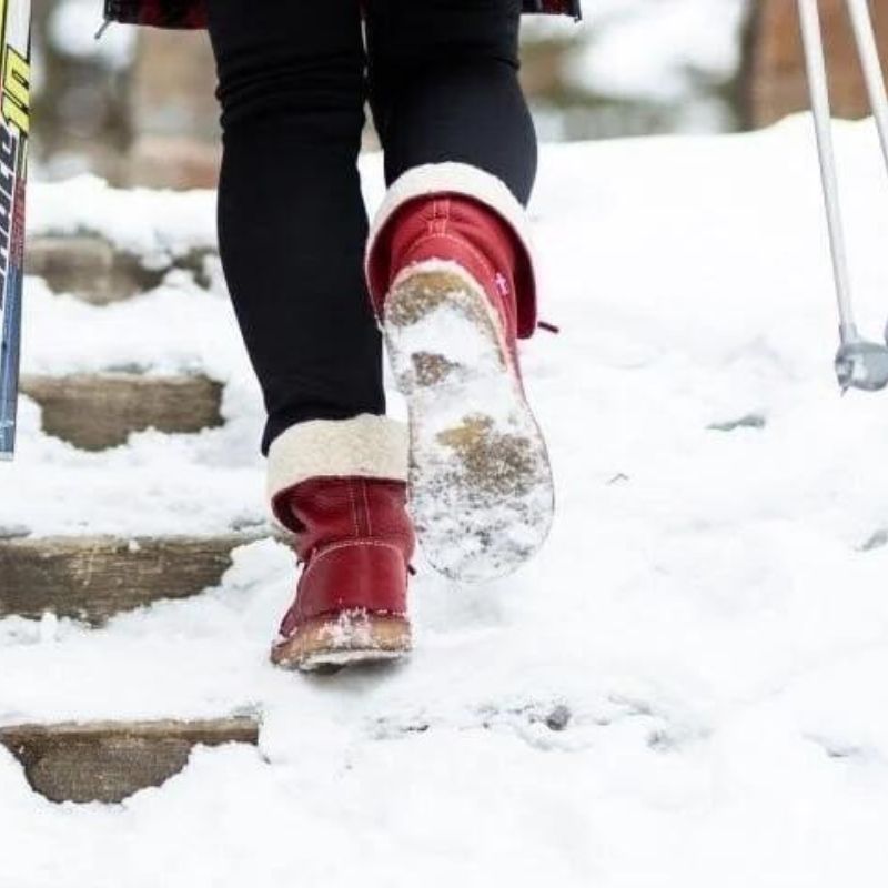 Waterproof Orthopedic Snow Boots Women with Arch Support and Fur Lining for Winter Comfort 7